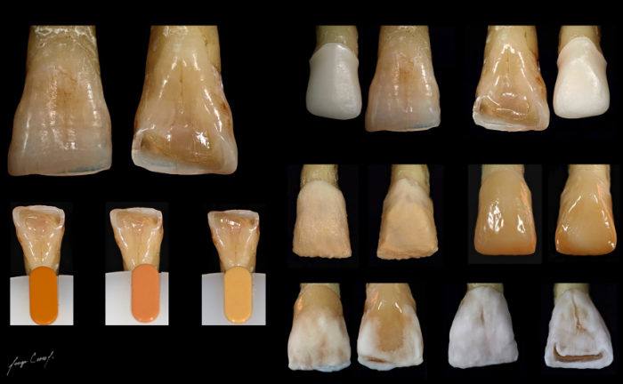 ESTRATIFICACIÓN LÓGICA NATURAL – VITA VM 9