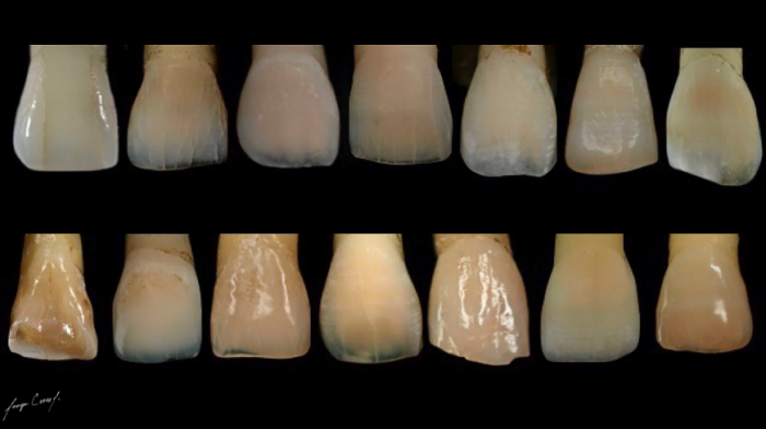 ESTRATIFICACIÓN LOGICA NATURAL – VMK Master